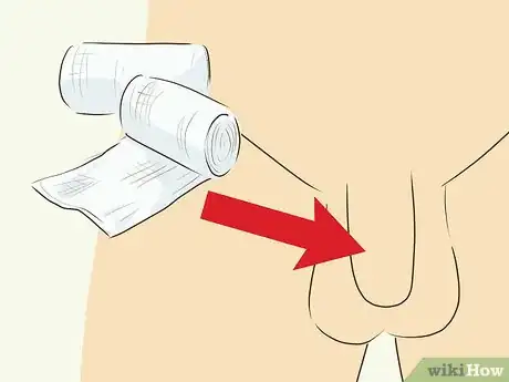 Image titled Tuck and Tape Step 5