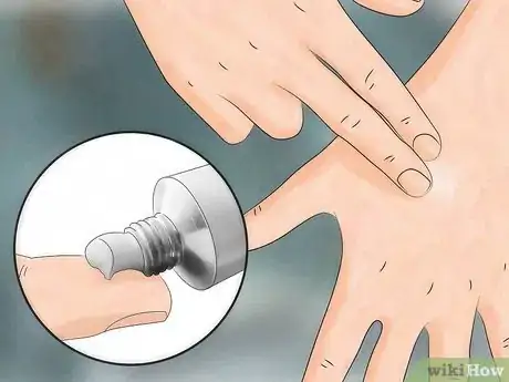 Image titled Reduce the Pain of Gnat Bites Step 5