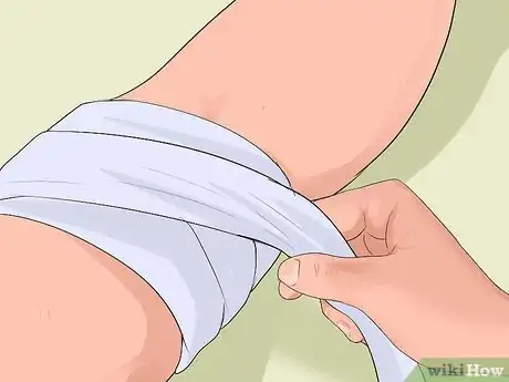 Image titled Treat Severe Bleeding During First Aid Step 6