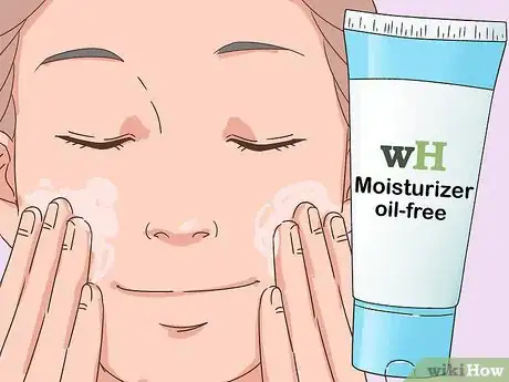 Image titled Treat Nodular Acne Step 11
