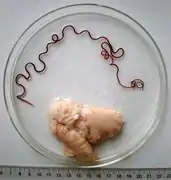 Philometra fasciati (Nematoda, Philometridae), a parasite of the ovary of the blacktip grouper