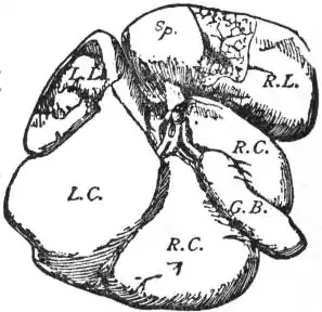 EB1911 - Liver - Fig. 5.—Human Liver showing a reversion to the generalised mammalian type.jpg
