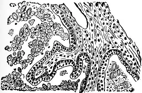 EB1911 Coccidia, Fig. 1—Section through Rabbit's Liver.jpg