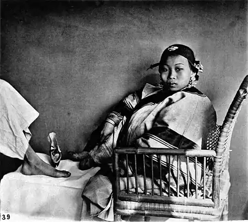 Female compressed foot, and natural foot.jpg