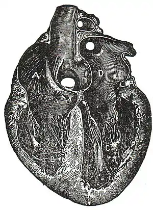 NSRW Human Heart.jpg