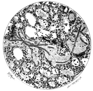 Tropical Diseases - Fig 100.png