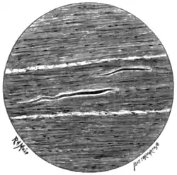 Tropical Diseases - Fig 102.png