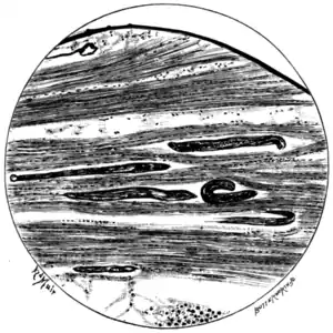 Tropical Diseases - Fig 104.png