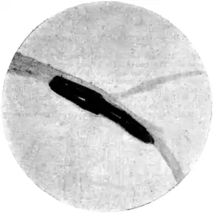 Tropical Diseases - Fig 112.png