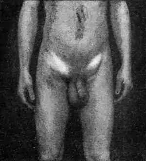 Tropical Diseases - Fig 115.png