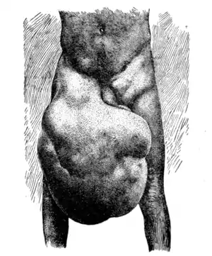 Tropical Diseases - Fig 116.png