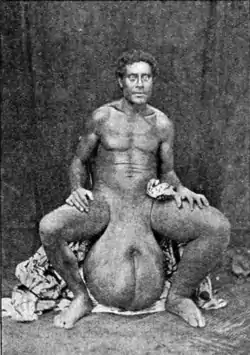 Tropical Diseases - Fig 120.png