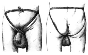 Tropical Diseases - Fig 122.png