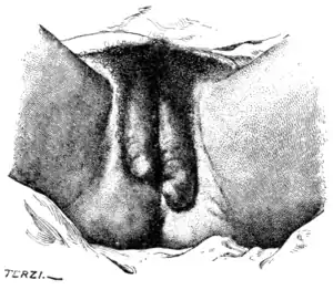 Tropical Diseases - Fig 123.png