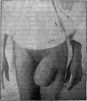 Tropical Diseases - Fig 126.png