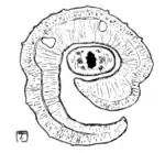 Tropical Diseases - Fig 131.png