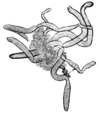 Tropical Diseases - Fig 137.png