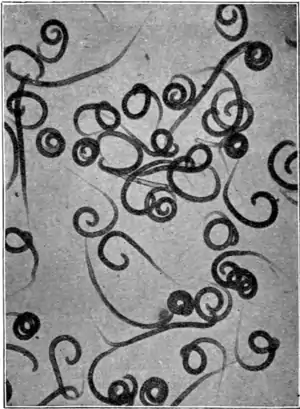 Tropical Diseases - Fig 150.png