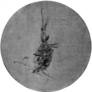 Tropical Diseases - Fig 152.png