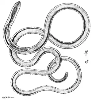 Tropical Diseases - Fig 155.png