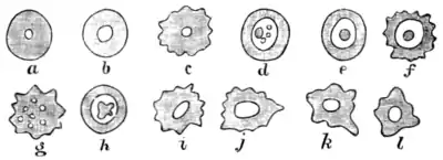 Tropical Diseases - Fig 17.png