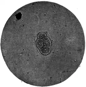 Tropical Diseases - Fig 173.png