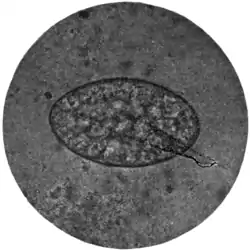 Tropical Diseases - Fig 194.png