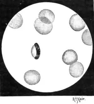 Tropical Diseases - Fig 5.png