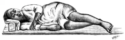 Tropical Diseases - Fig 76.png