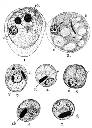 Tropical Diseases - Fig 79.png