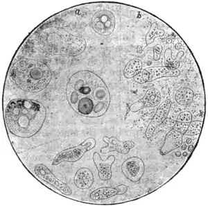 Tropical Diseases - Fig 80.png