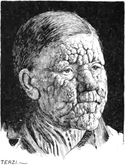 Tropical Diseases - Fig 85.png