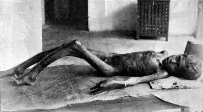 Tropical Diseases - Fig 91.png