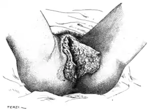 Tropical Diseases - Fig 95.png