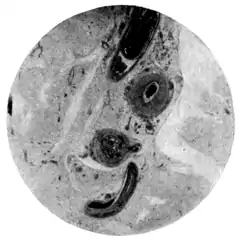 Tropical Diseases - Plate 14 Fig 1.png