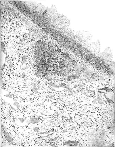 Tropical Diseases - Plate 8.png